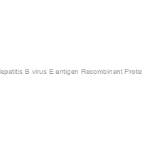 Hepatitis B virus E antigen Recombinant Protein